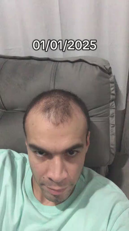 A Fórmula mágica para despertar folículos adormecidos