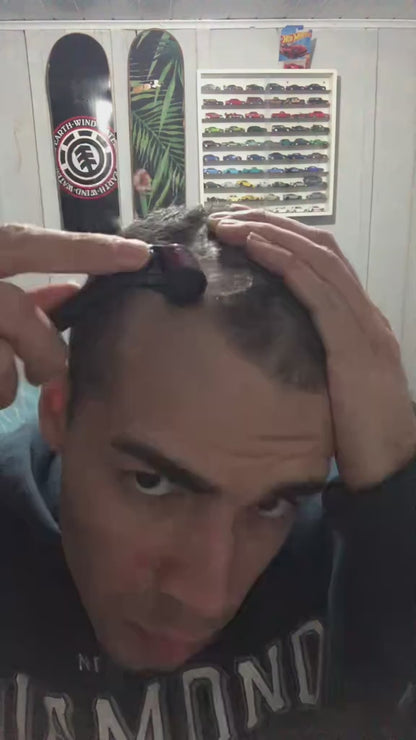 A Fórmula mágica para despertar folículos adormecidos